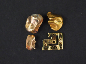 Vente aux enchères Elément de dents en or. Poids tel. 2,87 g  On y joint un élément de ba