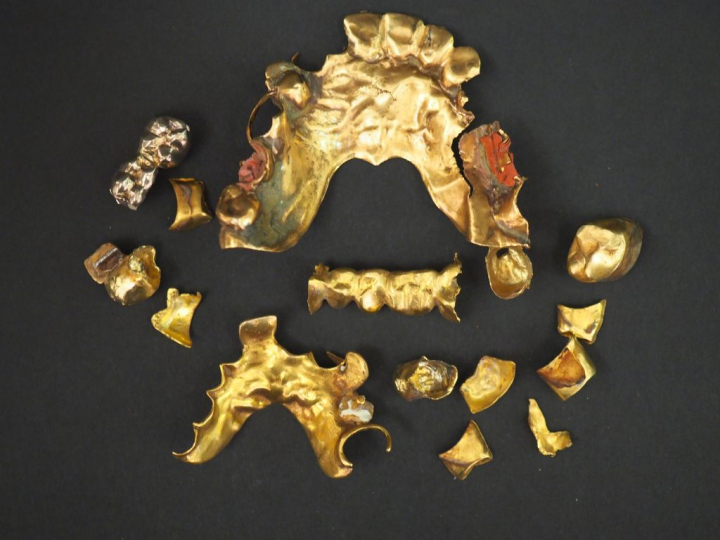 Or dentaire. Poids tel. 54,95 g