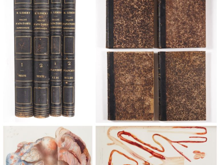 [MÉDECINE]. LEBERT (Hermann). TRAITÉ D’ANATOMIE PATHOLOGIQUE GÉNÉRALE 
