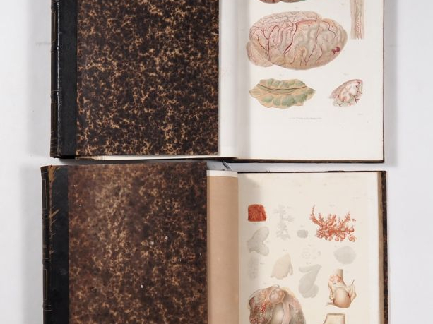 [MÉDECINE]. LEBERT (Hermann). TRAITÉ D’ANATOMIE PATHOLOGIQUE GÉNÉRALE 