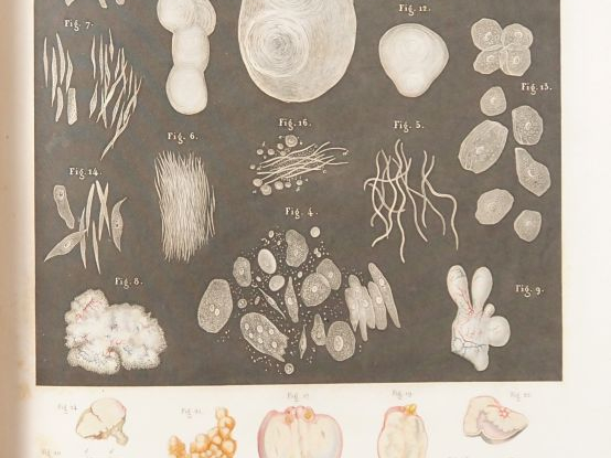 [MÉDECINE]. LEBERT (Hermann). TRAITÉ D’ANATOMIE PATHOLOGIQUE GÉNÉRALE 